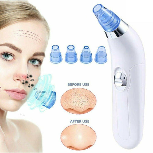 Blackhead Electric Pore Export Blackhead Cleaner $20.38 Dana Fashion Color: Pink Beauty Tools Product Information: Working method: Ultrasonic vibration Function: Blackhead suction Color: White, pink Packing List: Cleanser X1