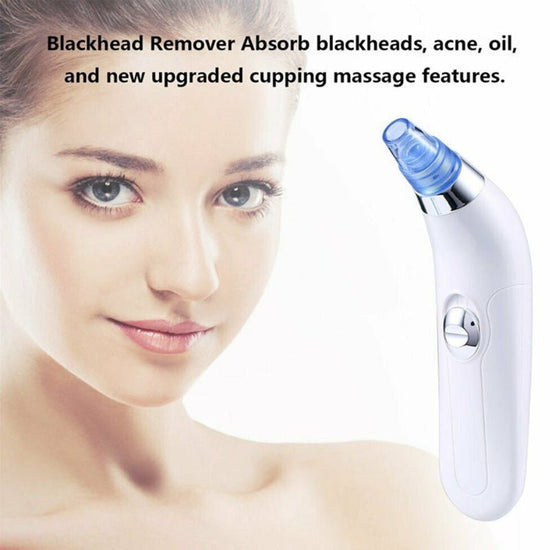 Blackhead Electric Pore Export Blackhead Cleaner $20.38 Dana Fashion Color: Pink Beauty Tools Product Information: Working method: Ultrasonic vibration Function: Blackhead suction Color: White, pink Packing List: Cleanser X1