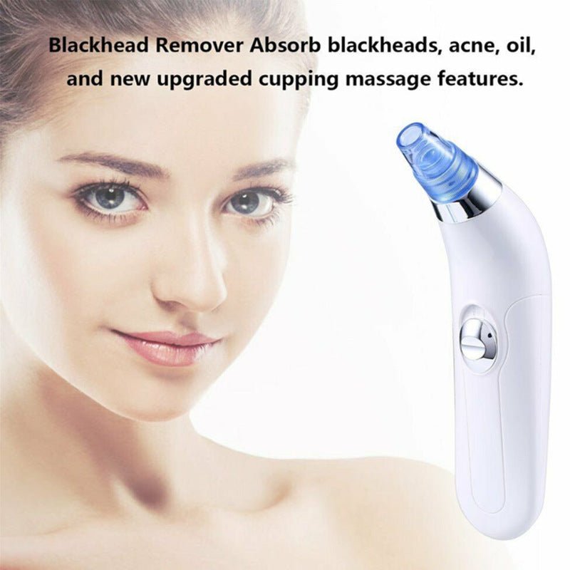 Blackhead Electric Pore Export Blackhead Cleaner $20.38 Dana Fashion Color: Pink Beauty Tools Product Information: Working method: Ultrasonic vibration Function: Blackhead suction Color: White, pink Packing List: Cleanser X1