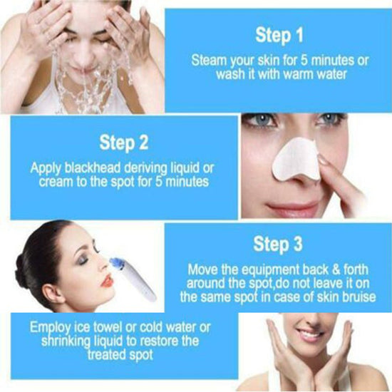 Blackhead Electric Pore Export Blackhead Cleaner $20.38 Dana Fashion Color: Pink Beauty Tools Product Information: Working method: Ultrasonic vibration Function: Blackhead suction Color: White, pink Packing List: Cleanser X1