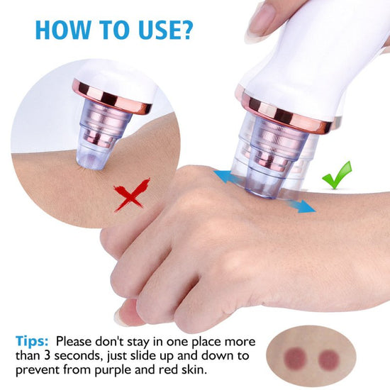 Blackhead Instrument Electric Suction Facial Washing Instrument Beauty Acne Cleaning Blackhead Suction Instrument $30.53 Dana Fashion Color: A Style Beauty Tools Overview Functions: 1. Remove Blackhead, deeply clean face 2. For acne, pimple skin treatment