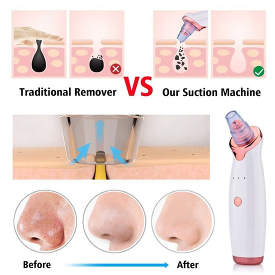 Blackhead Instrument Electric Suction Facial Washing Instrument Beauty Acne Cleaning Blackhead Suction Instrument $30.53 Dana Fashion Color: A Style Beauty Tools Overview Functions: 1. Remove Blackhead, deeply clean face 2. For acne, pimple skin treatment