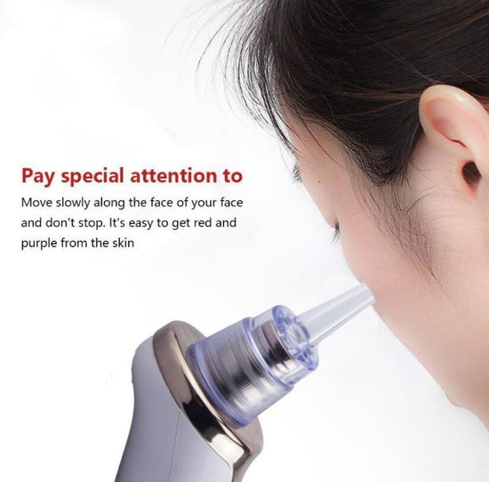 Blackhead Instrument Electric Suction Facial Washing Instrument Beauty Acne Cleaning Blackhead Suction Instrument $30.53 Dana Fashion Color: A Style Beauty Tools Overview Functions: 1. Remove Blackhead, deeply clean face 2. For acne, pimple skin treatment