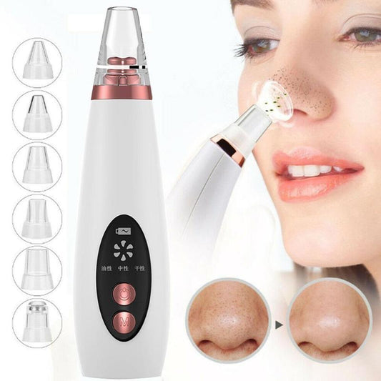 Blackhead Pore Vacuum Cleaner Nose Cleanser Blackheads Remover Blackhead Acne Removal Button Face Suction Beauty Skin Care Tool $28.22 Dana Fashion Color: White Model: USB Beauty Tools Name: microcrystalline blackhead instrument Product model: ly-9128 Inp