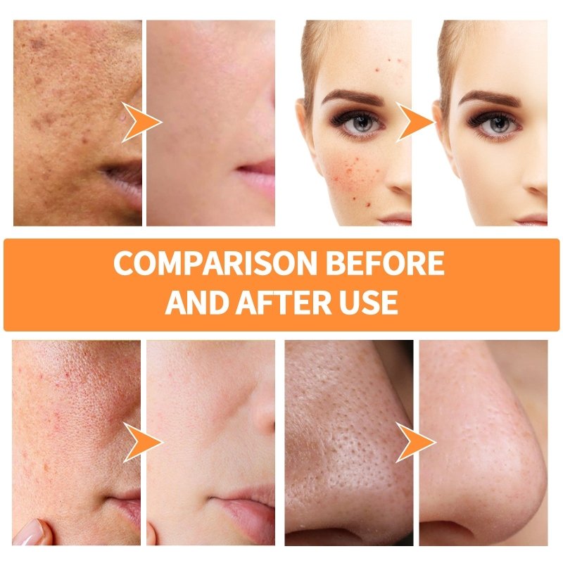 Deep Pore Cleansing Skin Solid Facial Mask $33.46 Dana Fashion style: 40g Beauty Tools Product information : Specification: Normal specification Net content: 40g(g/ml) Product specifications: 40g Ingredients: water, kaolin, diatomite, turmeric extract, wi