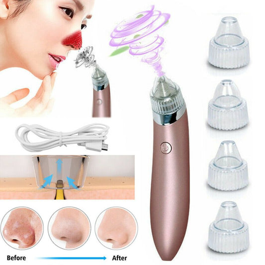 Electric Blackhead Vacuum Pore Cleaner Acne Pimple Remover Strong Suction Tool Electric Blackhead Remover Pore Vacuum Suction Diamond Dermabrasion Face Cleaner $25.00 Dana Fashion Color: As Picture Beauty Tools Feature: Can be used to remove blackhead, ac