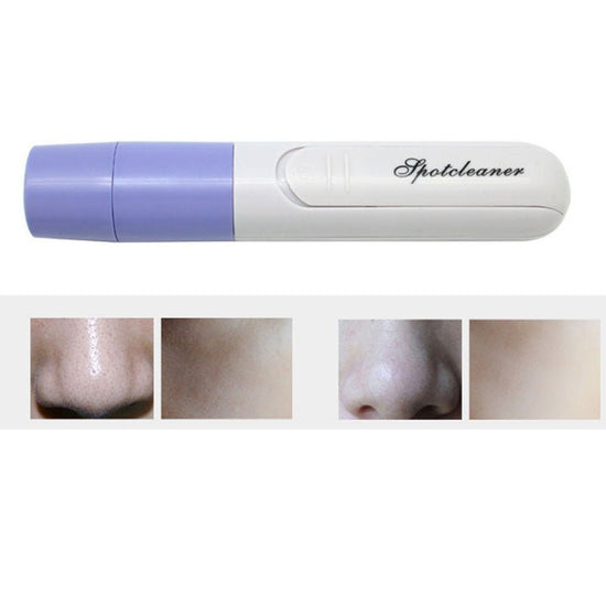 Electric Pore Cleanser Facial Massager $14.25 Dana Fashion default: default Beauty Tools Description: 1. Minimizes the appearance of large pores and helps to remove dirt that causes acne & blackheads. 2. Start with the nose cup to clean the corners around