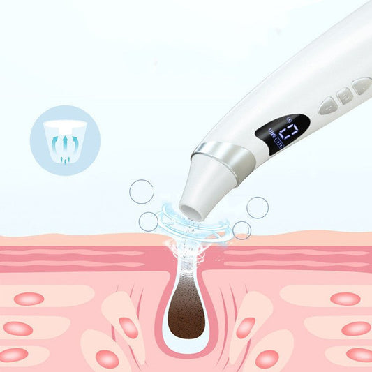 Electric Visual Blackhead Suction Instrument Household Cleansing Pore Cleaner For Skin Equipment Skin Care Tool $35.99 Dana Fashion Color: White power: USB Beauty Tools Overview: 1.Added visual function, connect the mobile APP to see the skin picture clea