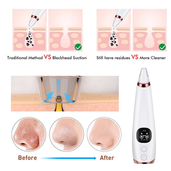 Facial instrument cleanser $43.36 Dana Fashion Color: White Beauty Tools Input voltage: 5V Input current: < 1A Bare weight: 124g Battery capacity: 850MAH Battery type: lithium battery Product suction: 53KPA Charge time: about 200 minutes Usage time: about