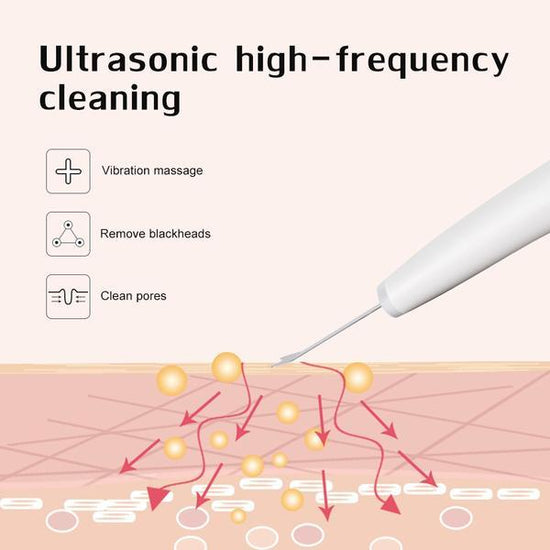 The Ultimate Face Cleaner $89.99 Dana Fashion Color: White Beauty Tools Features: Ultrasound: Using the principle of ultrasound, enter the skin's epidermis to remove surface grease and dirt while cleaning up waste impurities. Operation introduction: 1. Wi