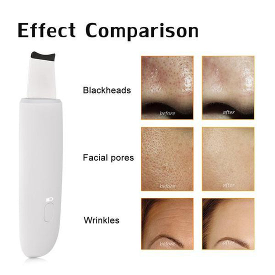 The Ultimate Face Cleaner $89.99 Dana Fashion Color: White Beauty Tools Features: Ultrasound: Using the principle of ultrasound, enter the skin's epidermis to remove surface grease and dirt while cleaning up waste impurities. Operation introduction: 1. Wi