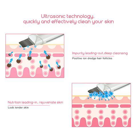 Ultrasonic Skin Scrubber Face Cleanser Blackhead Acne Removal Facial Spa Vibration Massager Ultrasound Peeling Clean Machine 394 $43.50 Dana Fashion specification: EU Beauty Tools Produc Ultrasonic shovel blade function 1, pain sore: Ultrasonic vibration,